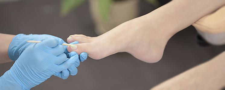 Desafios e cuidados para os pés de pessoas com diabetes