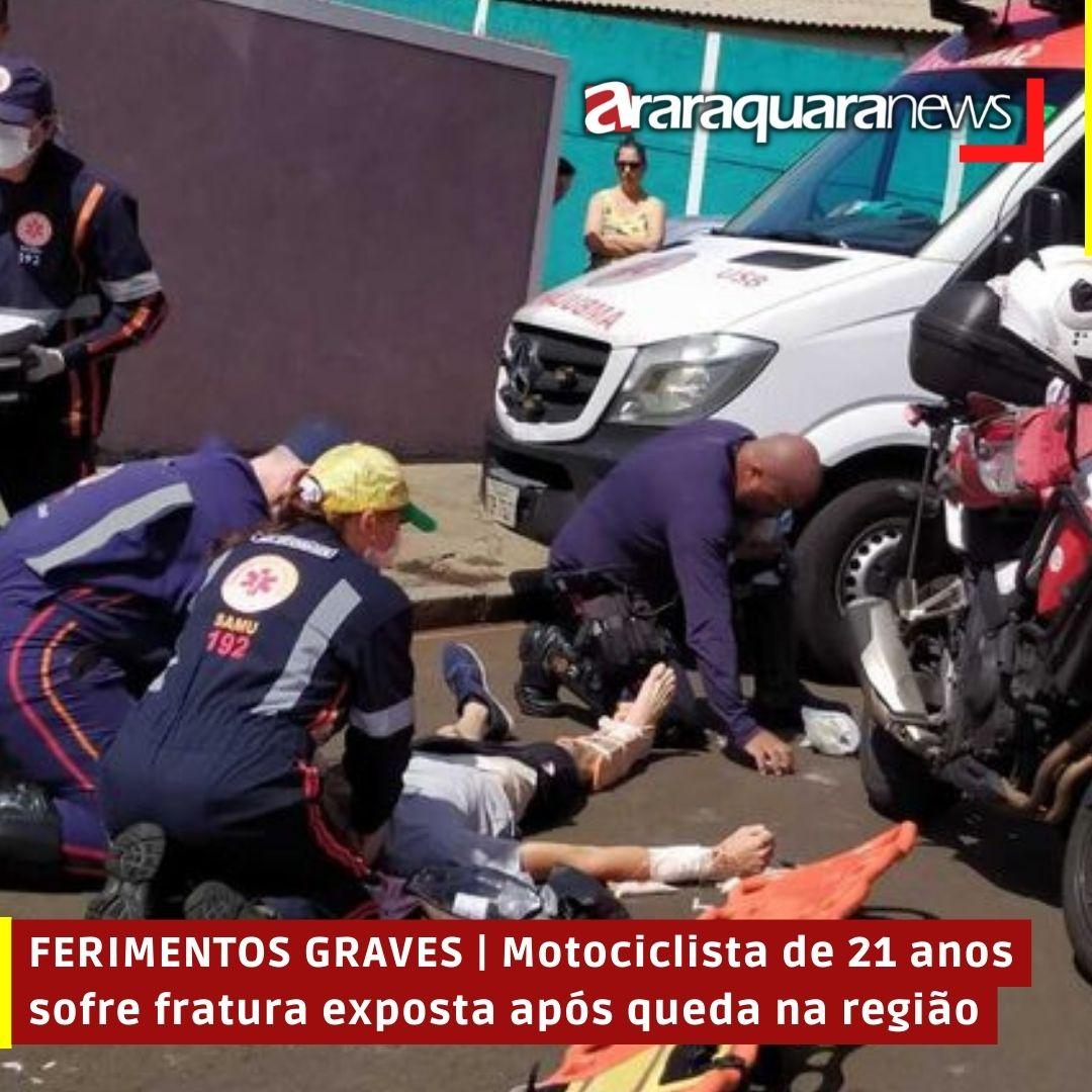 FERIMENTOS GRAVES | Motociclista de 21 anos sofre fratura exposta após queda na região