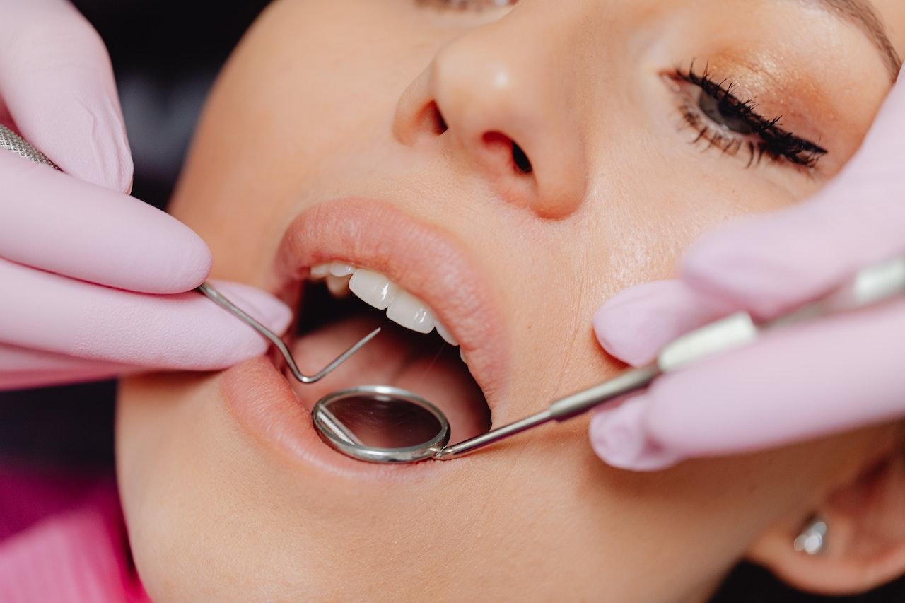 Lente de contato dental: os benefícios que você precisa conhecer