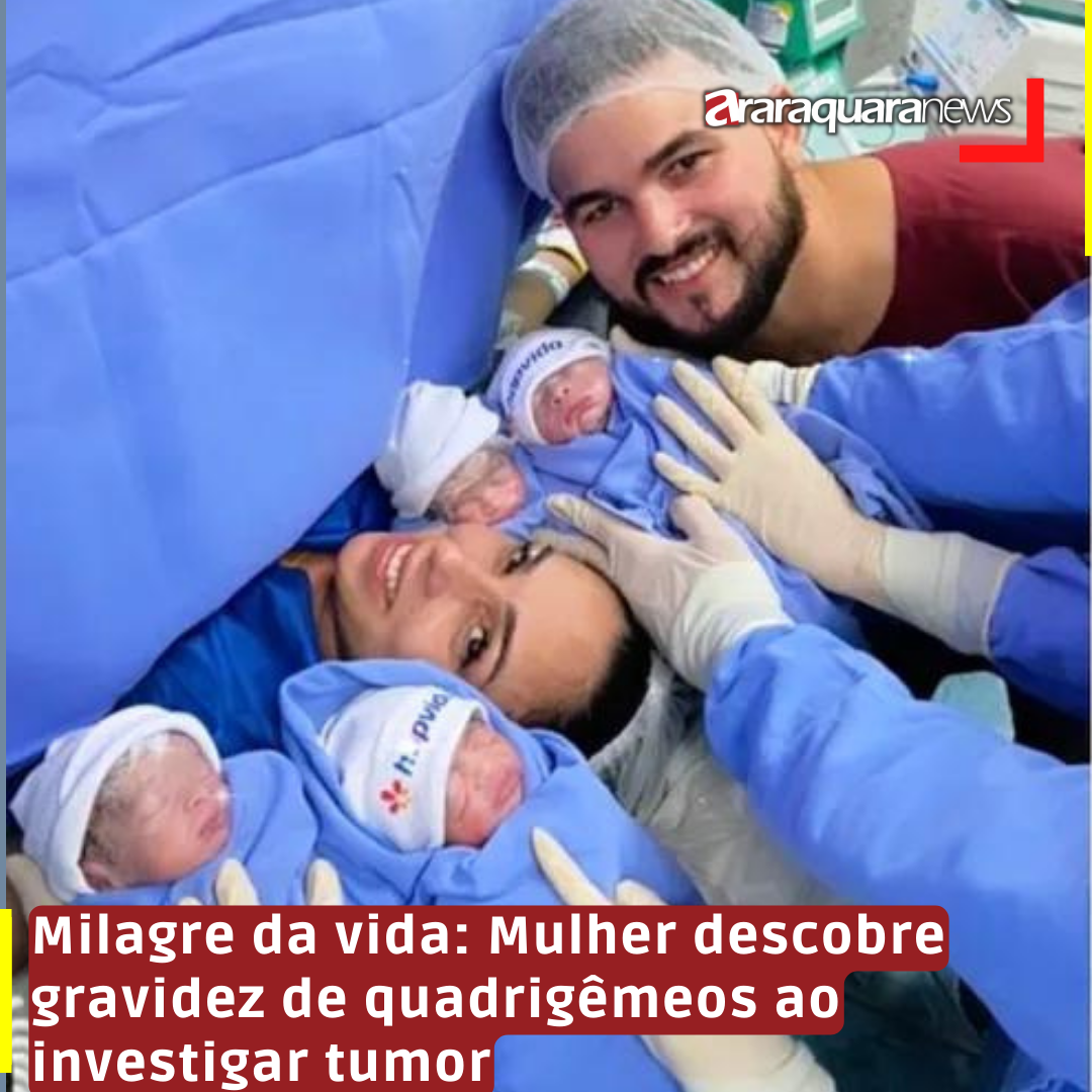 Milagre da vida: Mulher descobre gravidez de quadrigêmeos ao investigar tumor