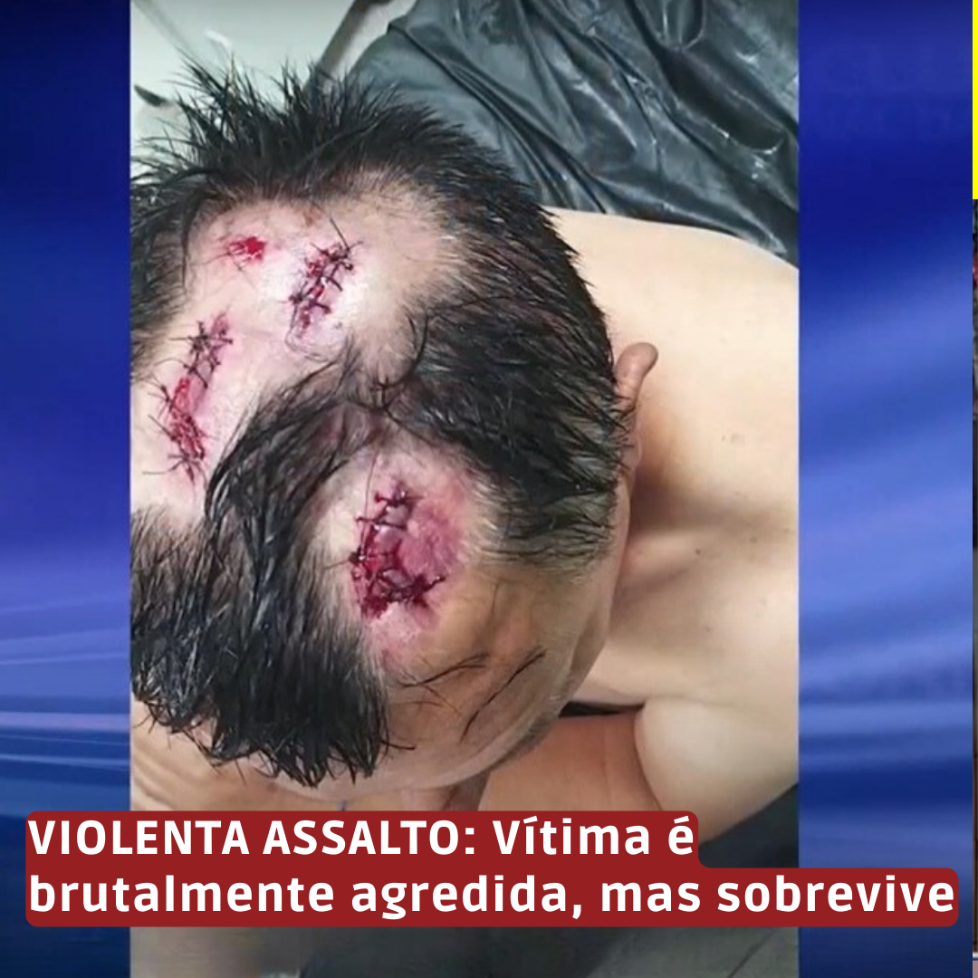 VIOLENTA ASSALTO: Vítima é brutalmente agredida, mas sobrevive