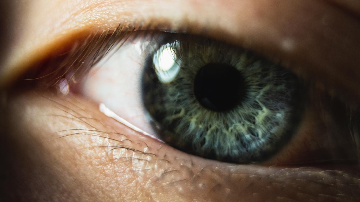 CIRURGIA DE CATARATA PERMITE REJUVENESCIMENTO OCULAR