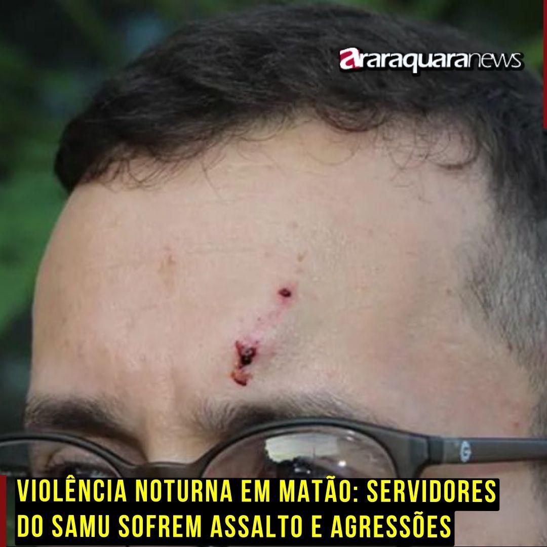 Violência Noturna em Matão: Servidores do SAMU Sofrem Assalto e Agressões