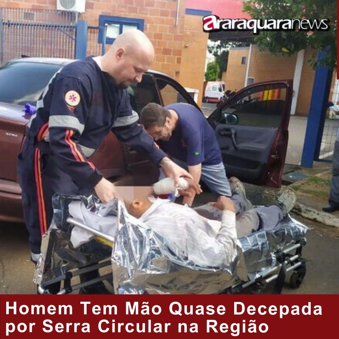 Homem Tem Mão Quase Decepada por Serra Circular na Região
