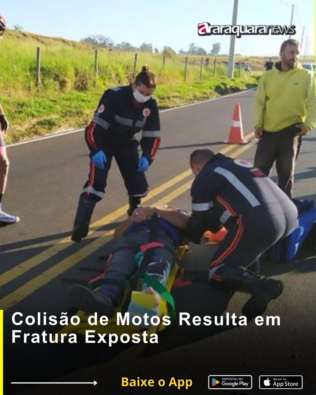 Colisão de Motos Resulta em Fratura Exposta