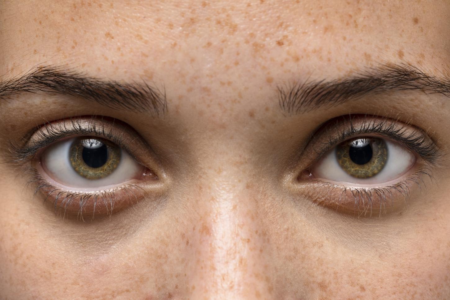 GLAUCOMA: DOENÇA DE INÍCIO ASSINTOMÁTICO QUE PROVOCA PERDA IRREVERSÍVEL DA VISÃO