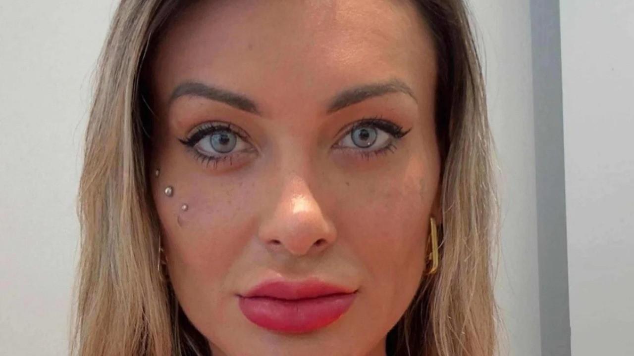 ANDRESSA URACH ALTERA COR DOS OLHOS EM CIRURGIA PROIBIDA NO BRASIL E ENFRENTA DORES INTENSAS