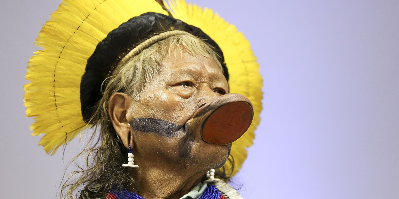 Cacique Raoni mantém saúde estável em UTI após cirurgias