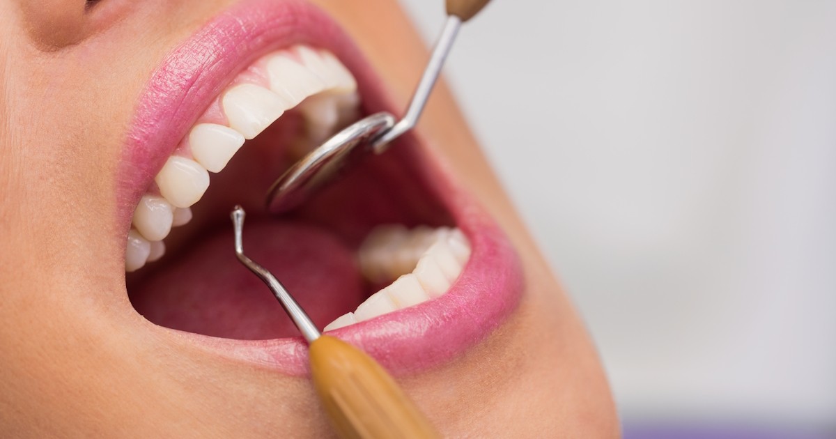 Prefeitura aponta necessidade de contratar 27 dentistas após 7.945 atendimentos