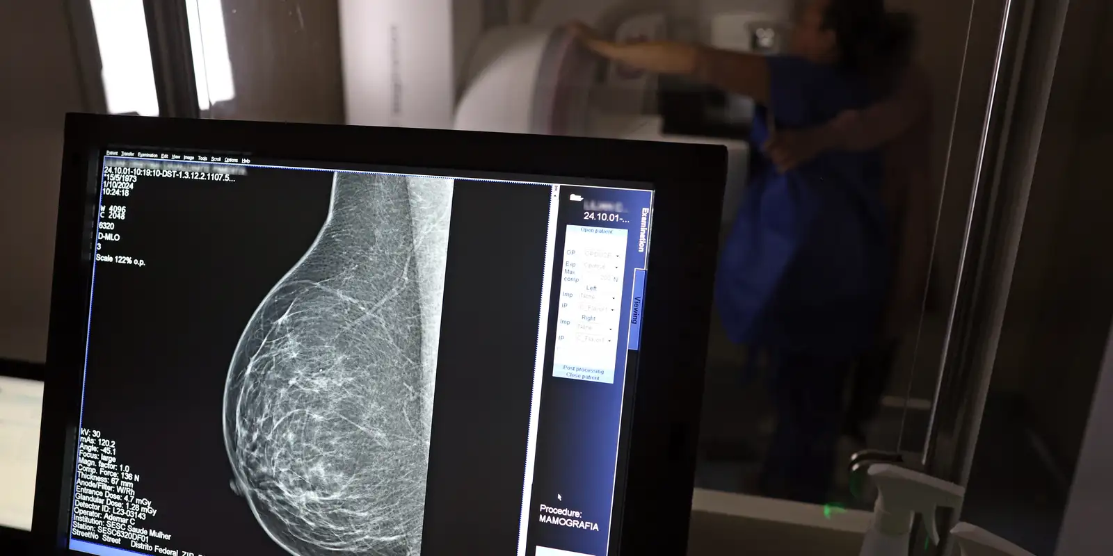 Plano de saúde deve cobrir mamografia digital sem limite de idade