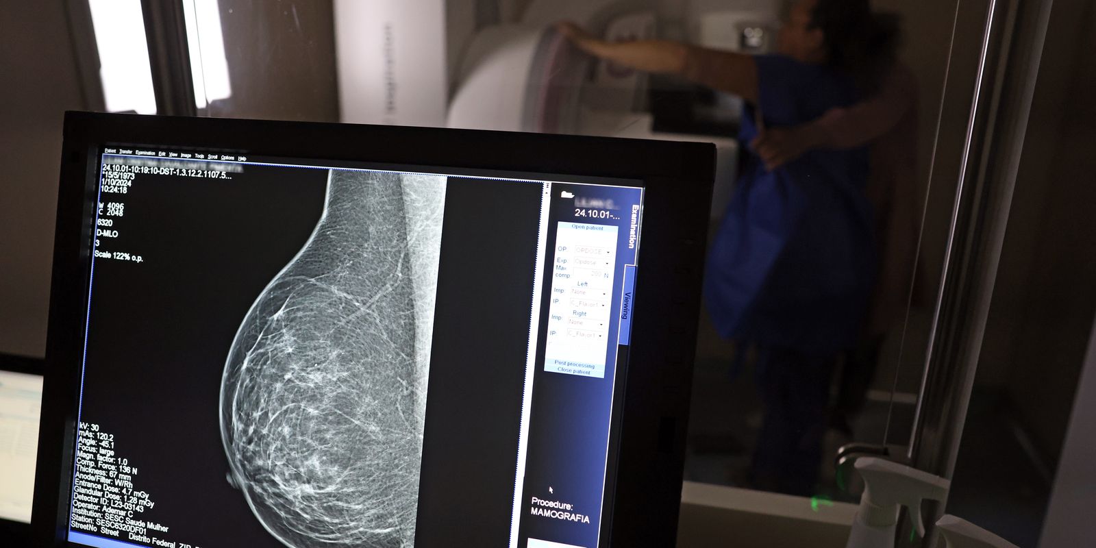 Guia médico orienta como evitar a recusa de mamografia digital
