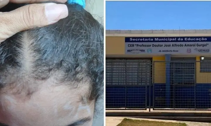 Professora é acusada de escrever boba na testa de aluna em Araraquara