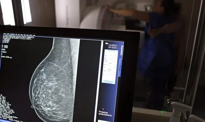 Guia médico orienta como evitar a recusa de mamografia digital