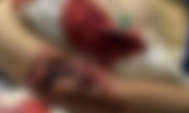 Menino de 12 anos sofre ataque de pitbull e fica com braço dilacerado