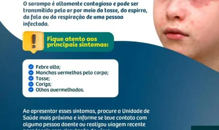 Prefeitura reforça alerta sobre a vacinação contra o sarampo