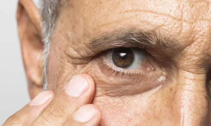 RISCO DE CEGUEIRA PODE SER REDUZIDO EM ATÉ 80% COM CHECK-UP REGULAR